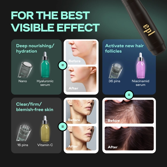 Premium Micro needling Pen For Face and Body with 16 Cartridge