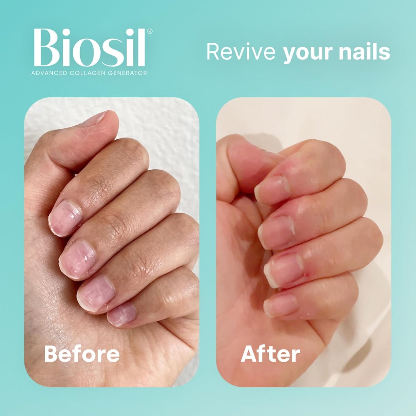 Biosil Collagen Generator - 60 Original Capsules - Generates & Protects Your Own Collagen - GMO Free - 30-Day Supply
